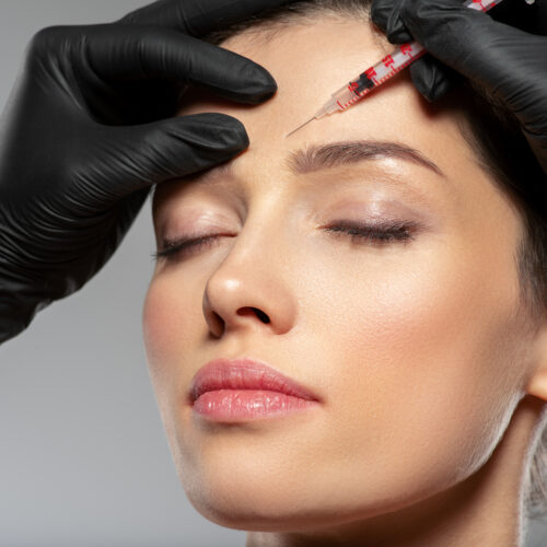 Botox for wrinkles