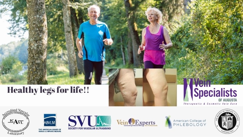 Treat vein issues such as varicose veins and spider veins and have healthy legs for life Healthy legs for life